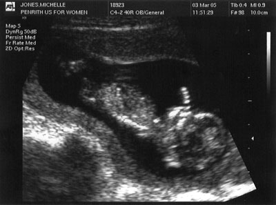 Ruby Sampson 3 March 2005